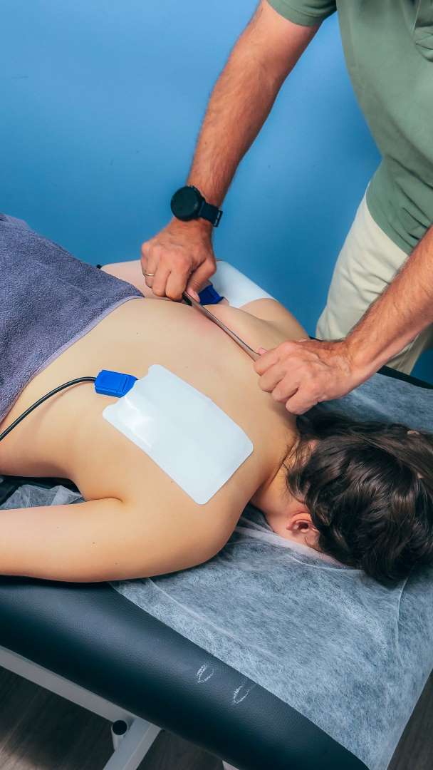 Βελονισμός & Ηλεκτροβελονισμός 